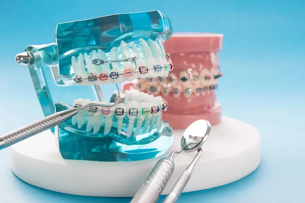 The History and Evolution of Orthodontics from Ancient to Modern Times