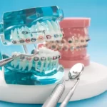 The History and Evolution of Orthodontics from Ancient to Modern Times