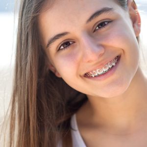 Beautiful teenage girl smiling with braces outdoors